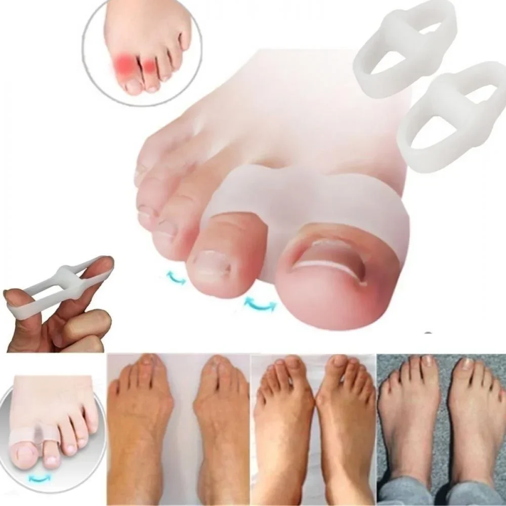 Correction Fluid White - 2-gaats bunion corrector pijnverlichting teenafscheiders gel